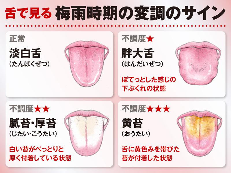 大きな舌を持つことの潜在的なリスク