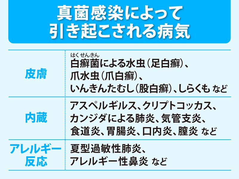 真菌感染